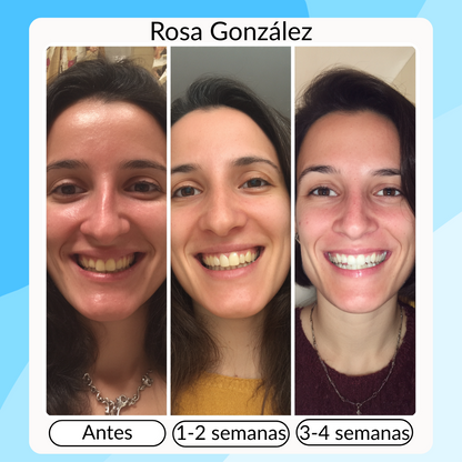 ELIMINA LAS MANCHAS Y EL MAL ALIENTO - smilekit™ TRANSFORMA TU SONRISA